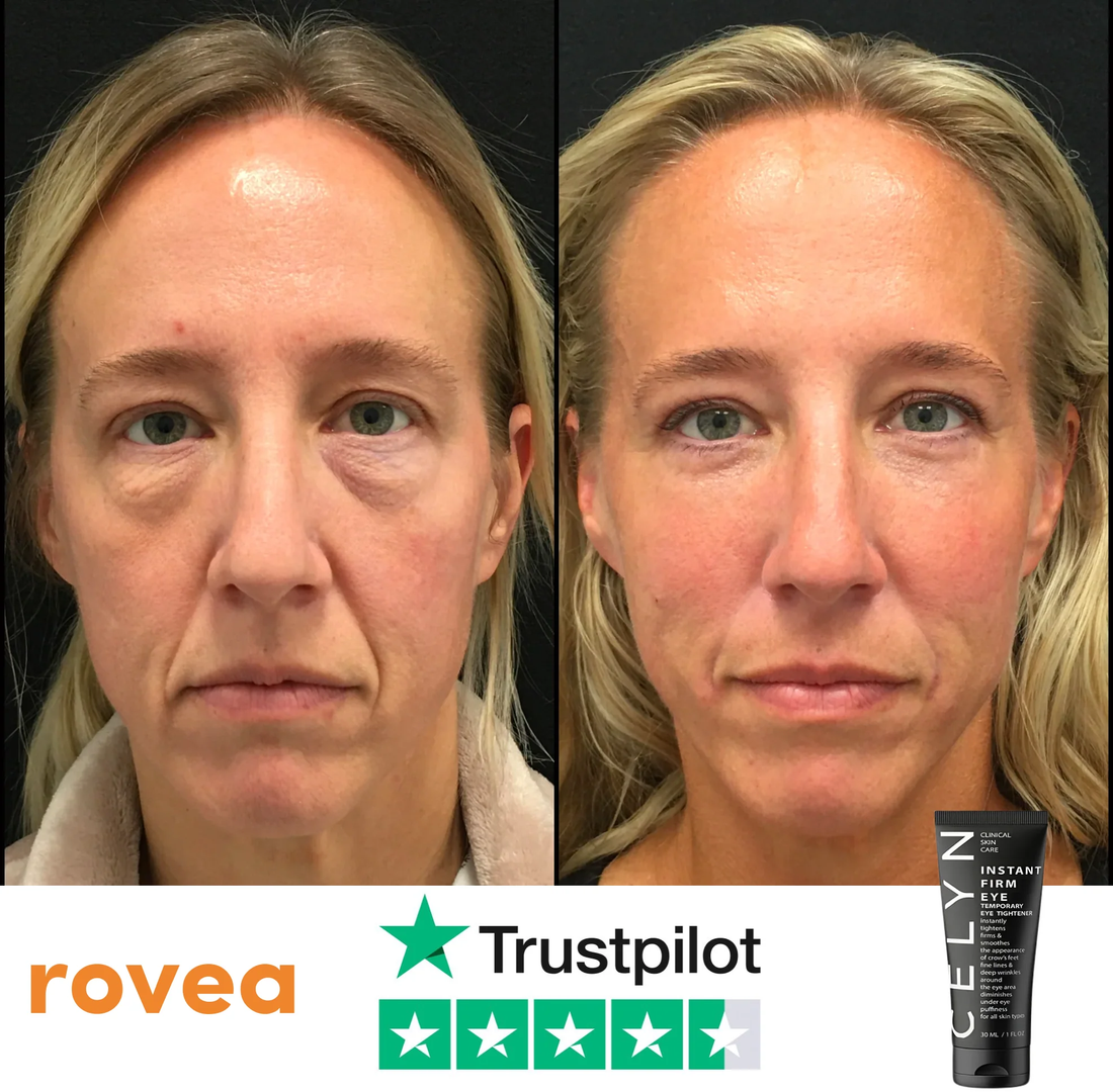 RoveaSkin Opinioni: Funziona Davvero o è una Truffa? Recensioni Reali