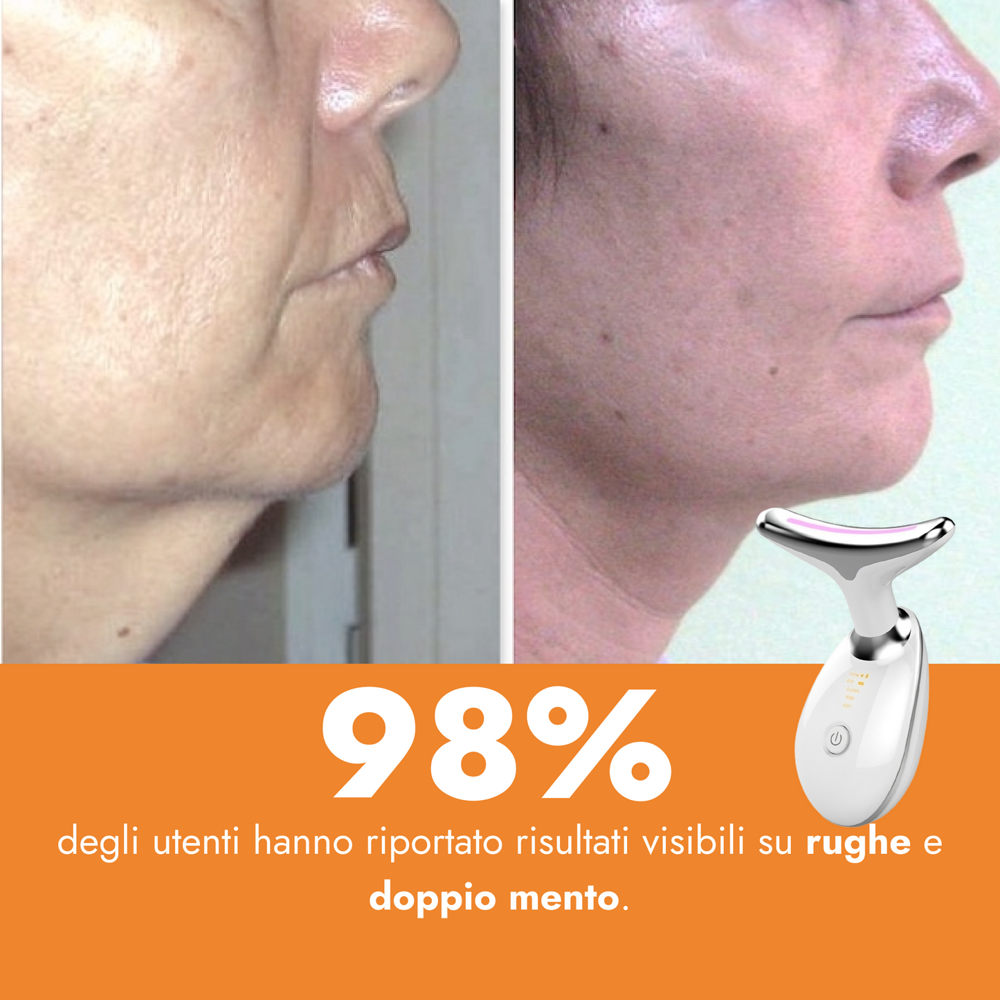 Dispositivo EMS – Effetto Lifting per Viso e Collo