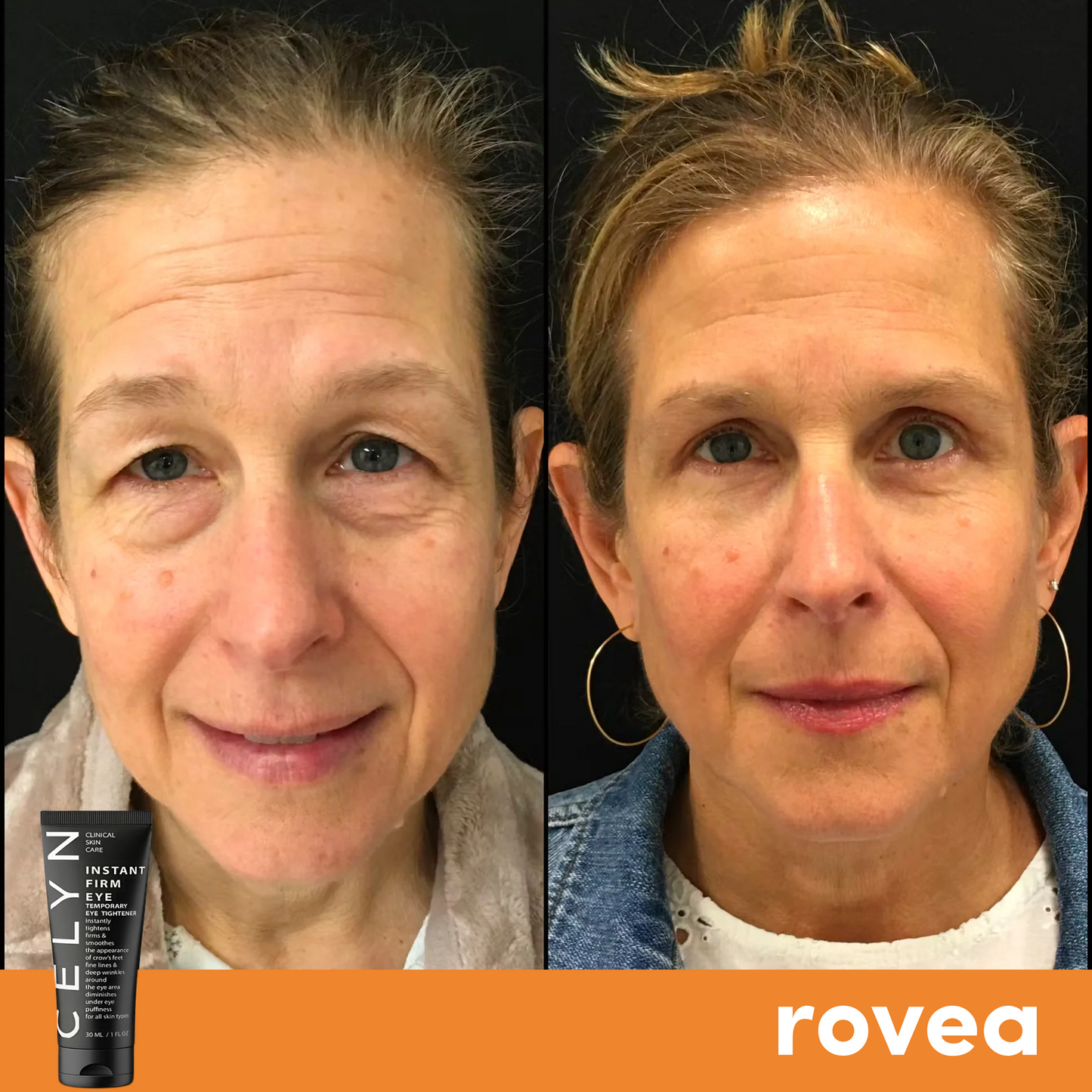 Crema Anti Occhiaie e Rughe Istantanea