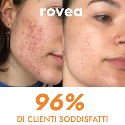 Siero Niacinamide + Vitamina C – Anti-macchie e Anti-acne